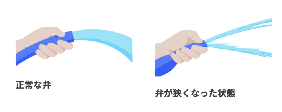 正常な弁と弁が狭くなった状態